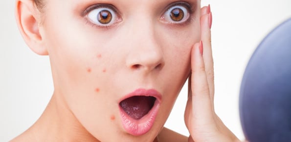 Dapsone Gel Farmaco Galenico In Farmacia Farmagalenica