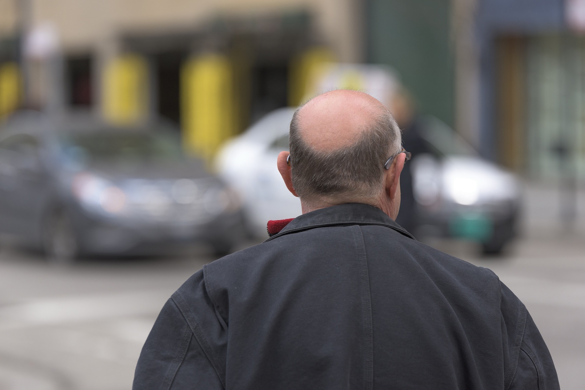 finasteride galenica per l'alopecia androgenica