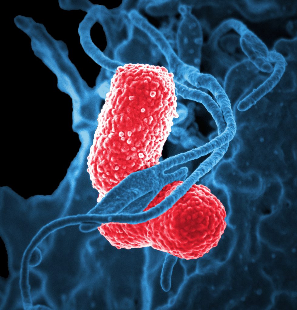 ibuprofene aerosol galenico polmonite interstiziale