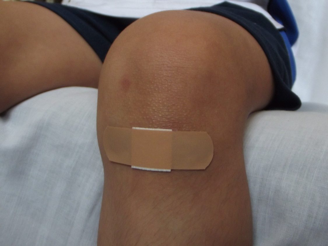 Amukine Med non c’è più? Ipoclorito di sodio galenico c’è