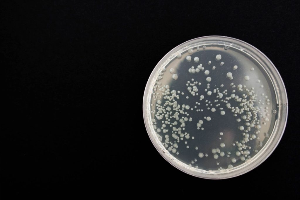 Piastra Petri con colonie di microrganismi su sfondo nero